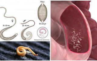 Hoe pinwormen bij volwassenen en kinderen te verwijderen