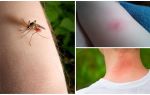 Quelle est la différence entre une piqûre de moustique et une piqûre d'insecte ou de tique?