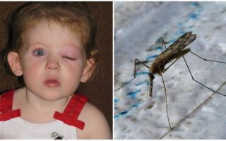 Ce trebuie să faceți dacă un copil are un ochi pufos după o mușcătură de țânțari