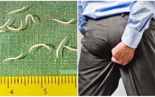 Symtom och behandling av pinworms hos vuxna