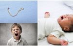 Các triệu chứng và điều trị giun đũa ở trẻ em