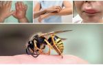 Erste Hilfe für ein Kind mit einer Wespenstich zu Hause