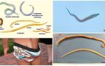Rozdíly Ascaris od pinworms a jiné červy