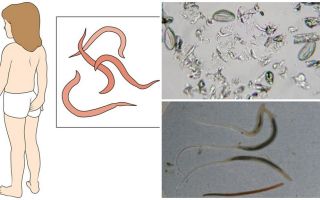 Wat zijn pinworms en hoe ze eruitzien