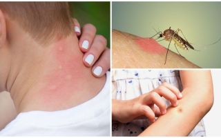 De ce țânțarul mușcă mâncărimea