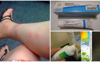 De ce la adulți și copii după mușcăturile de țânțari apar umflături decât pentru a trata