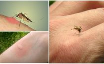 Perché le zanzare mordono alcune persone più di altre