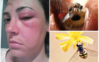 Ce se întâmplă dacă o albină în ochi și-a umflat