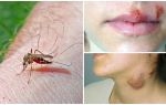 Quali malattie soffrono le zanzare