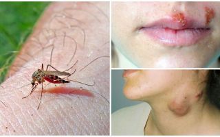 Sivrisinekler hangi hastalıklara yakalanır?