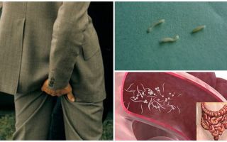 Behandeling van pinworms folk remedies