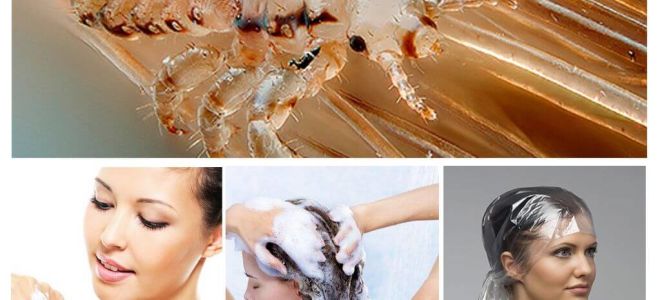 Pediculosis-shampoos voor kinderen en volwassenen