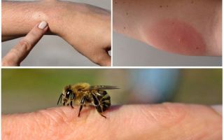 Алергична реакция към пчелното жило, какво да правите