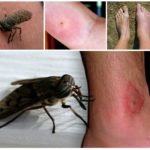 Insektbit på människokroppen