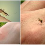 Sivrisinek ısırığı