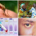 Zika, West Nile och Yellow Fever-virus