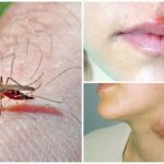 Malaria och tularemi för myggor