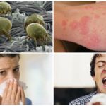 Alergia la acarienii de pat