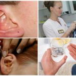 טיפול מקיף של קרדית האוזן