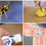 Remèdes populaires contre les piqûres d'insectes