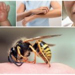 Reactie op een wespensteek bij een kind