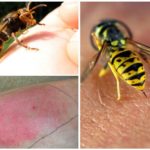 Pericolo di puntura di vespa