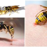 Wasp और मधुमक्खी डंक
