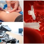 Krevní test na protilátky proti Giardia